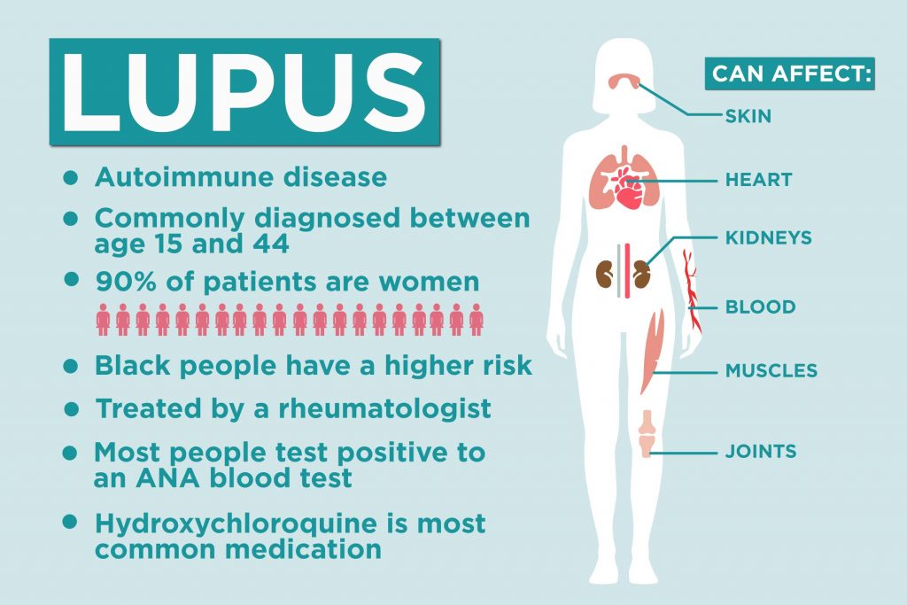 Lupus Points Chart